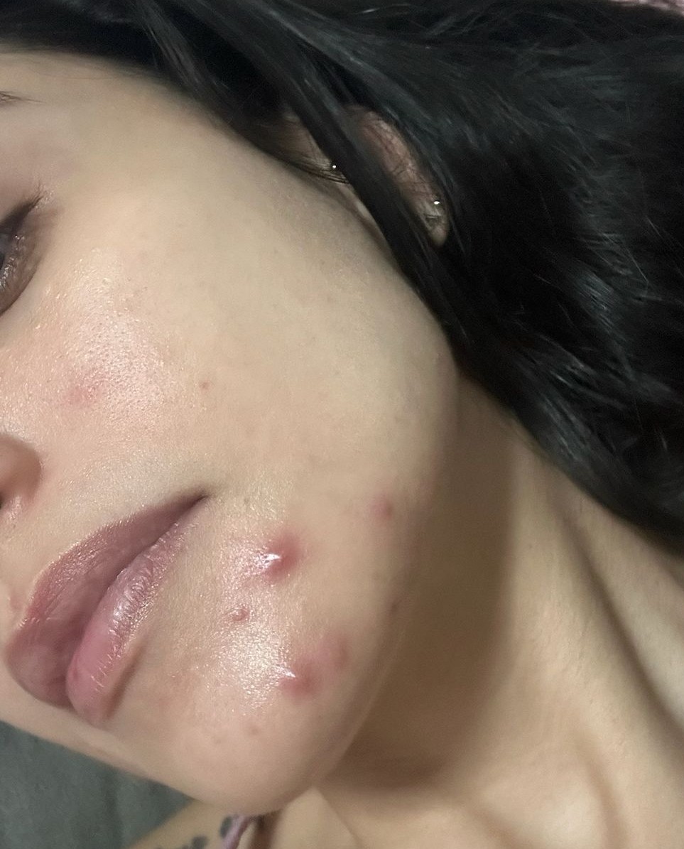Marina, 32 depois do protocolo